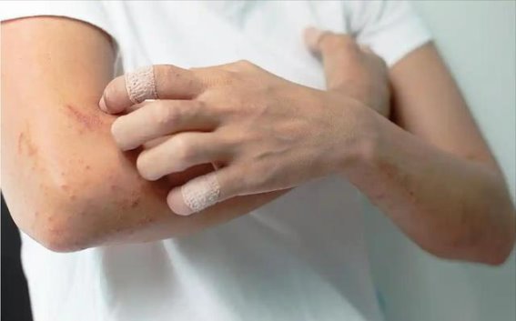 皮肤总是发痒？小心，这是身体在“喊救命”