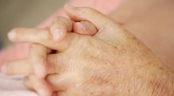 银屑病反复困扰，如何有效控制红斑？本维莫德来助力