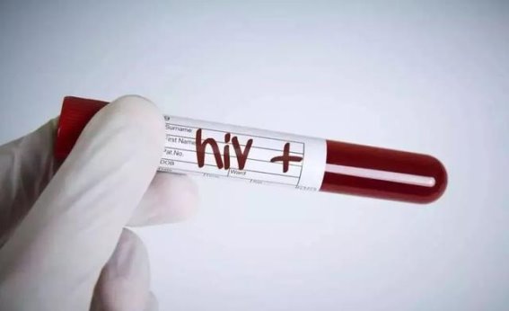 艾滋病隐性传播风险：如何在日常生活中守护健康