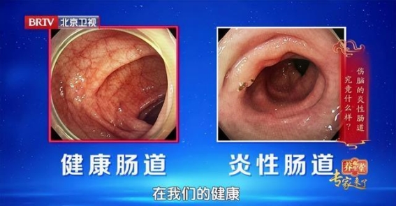 便秘可能加速老年痴呆！护肠食谱助你通便护脑