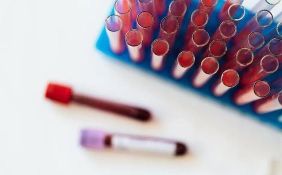 波立维与依折麦布同用引发出血风险的实情分析