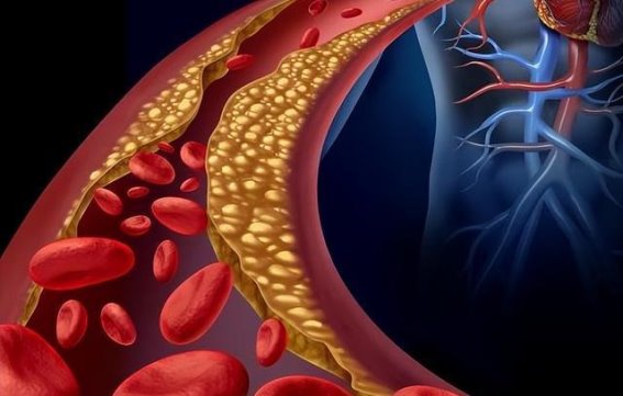 医生提醒：最能预防血管堵塞的行为，不是散步！而是做好这4件事