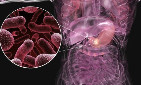 癌症专家的最后忠告：四条生活细节决定你的健康