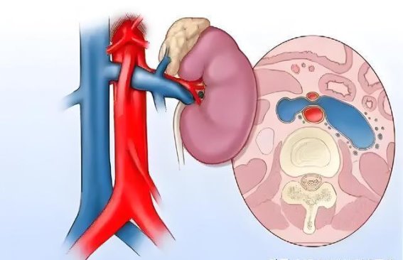 左肾萎缩的影响与应对：如何通过早期监测保护肾功能