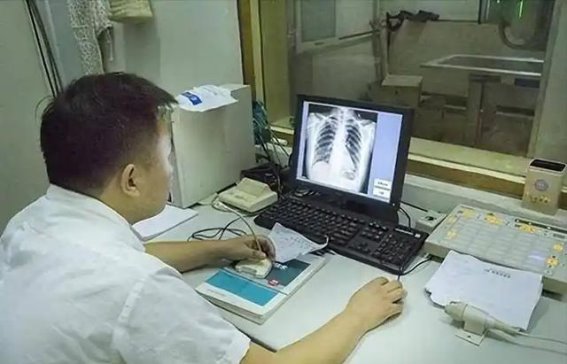 肺部CT检查需谨慎，医生提醒：三点必知事项